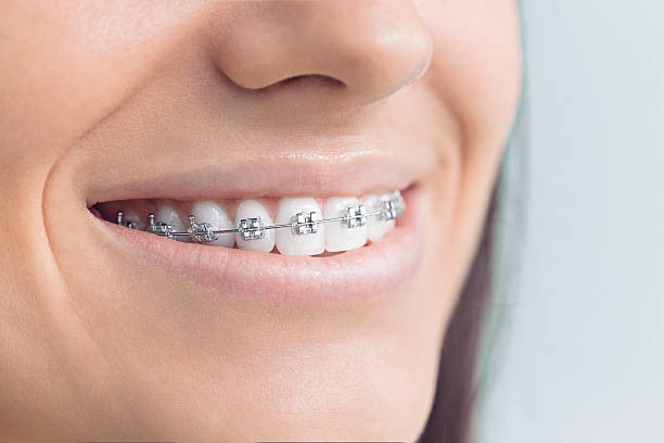 Best Veneers and Lumineers  in Edinburg, TX